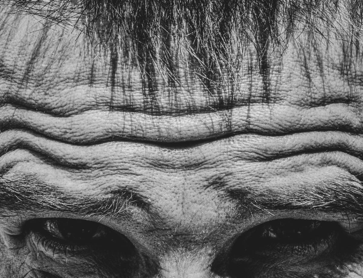 wrinkles - the sign of age